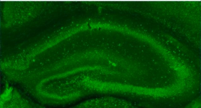 Anti-Dysbindin from rabbit, purified by affinity chromatography