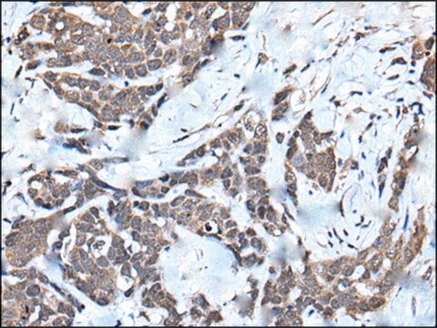 Anti-HNRNPU affinity isolated antibody