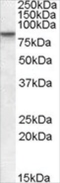 抗CLLD8/SETDB2抗体 ヤギ宿主抗体 affinity isolated antibody, buffered aqueous solution