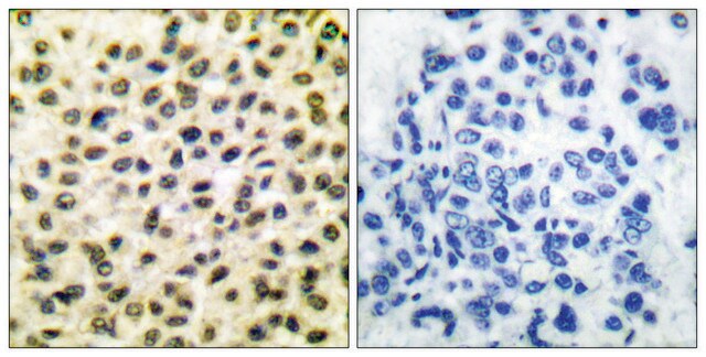 Anti-FOS antibody produced in rabbit affinity isolated antibody