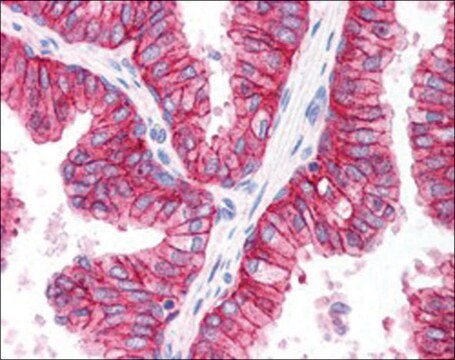 Anti-ABCC4/MRP4 antibody produced in goat affinity isolated antibody, buffered aqueous solution