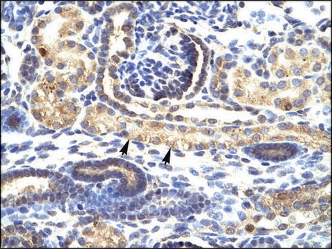 Anti-SNAI1 affinity isolated antibody