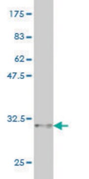 Monoclonal Anti-CDSN antibody produced in mouse clone 6F11, purified immunoglobulin, buffered aqueous solution