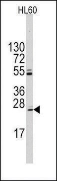 Anti-UBTD1 (C-term Q173) antibody produced in rabbit Ig fraction of antiserum, buffered aqueous solution