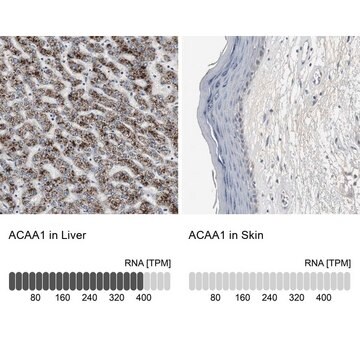 抗-ACAA1 兔抗 Ab1, Prestige Antibodies&#174; Powered by Atlas Antibodies, affinity isolated antibody, buffered aqueous glycerol solution