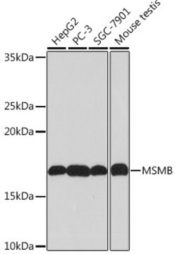 Anti-MSMB Antibody, clone 4L8B5, Rabbit Monoclonal