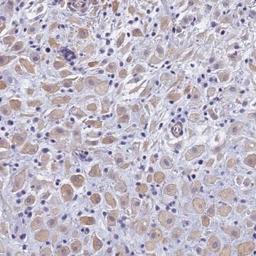 Anti-TRIM64 antibody produced in rabbit Prestige Antibodies&#174; Powered by Atlas Antibodies, affinity isolated antibody, buffered aqueous glycerol solution