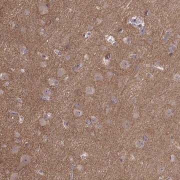 Anti-APC antibody produced in rabbit Prestige Antibodies&#174; Powered by Atlas Antibodies, affinity isolated antibody, buffered aqueous glycerol solution