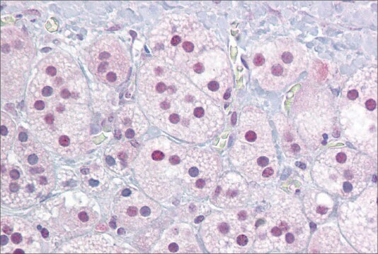 抗NR4A1抗体 ウサギ宿主抗体 affinity isolated antibody