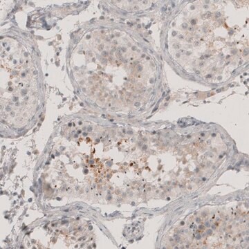 Anti-CT83 antibody produced in rabbit Prestige Antibodies&#174; Powered by Atlas Antibodies, affinity isolated antibody, buffered aqueous glycerol solution