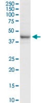 Anti-RRM2 antibody produced in rabbit purified immunoglobulin, buffered aqueous solution