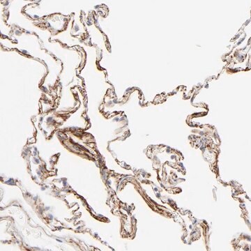 抗LTBP2 ウサギ宿主抗体 affinity isolated antibody, buffered aqueous glycerol solution