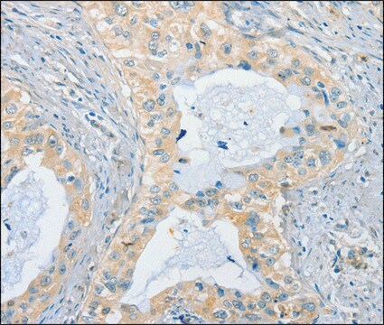 Anti-CHRNA2 antibody produced in rabbit affinity isolated antibody