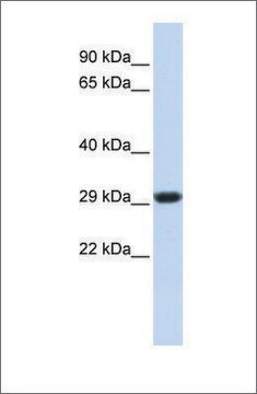 抗SDHB抗体 ウサギ宿主抗体 affinity isolated antibody