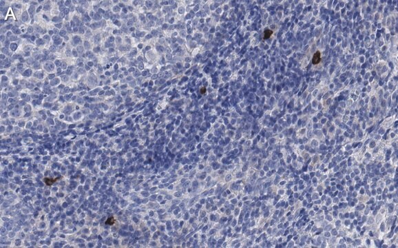 Anti-NLRP3 Antibody, clone 4B4 ZooMAb&#174; Rabbit Monoclonal recombinant, expressed in HEK 293 cells