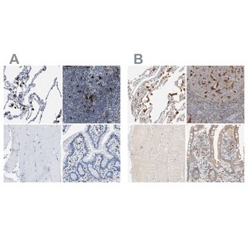 Anti-CAPG antibody produced in rabbit Prestige Antibodies&#174; Powered by Atlas Antibodies, affinity isolated antibody, buffered aqueous glycerol solution