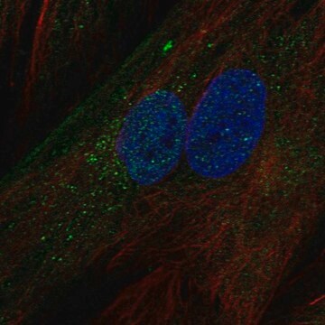 Anti-IGFBP5 antibody produced in rabbit Prestige Antibodies&#174; Powered by Atlas Antibodies, affinity isolated antibody