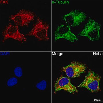 Anti-FAK Antibody, clone 7H8C4, Rabbit Monoclonal