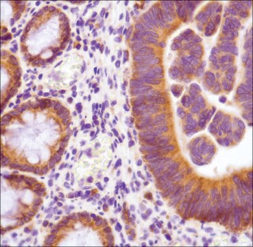 Anti-Thymidylate Synthase antibody, Rabbit monoclonal clone SP112, recombinant, expressed in proprietary host, affinity isolated antibody