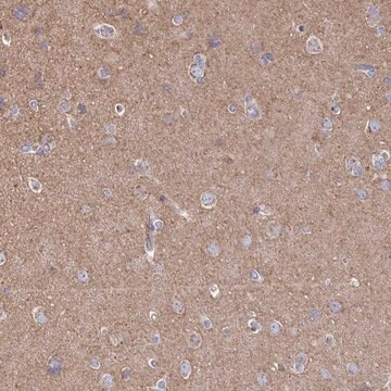 Anti-CLTC antibody produced in rabbit Prestige Antibodies&#174; Powered by Atlas Antibodies, affinity isolated antibody, buffered aqueous glycerol solution