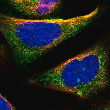 Anti-TOM1 antibody produced in rabbit Prestige Antibodies&#174; Powered by Atlas Antibodies, affinity isolated antibody