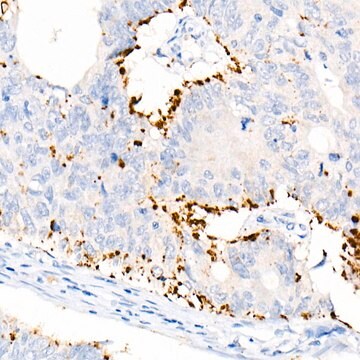 Anti-Perilipin-2 Antibody, clone 9W7Y9, Rabbit Monoclonal