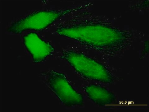 Monoclonal Anti-DDEF1 antibody produced in mouse clone 2G7, purified immunoglobulin, buffered aqueous solution