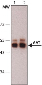 单克隆抗 &#945;-1-抗胰蛋白酶 (AAT) 小鼠抗 clone 1C2, purified from hybridoma cell culture