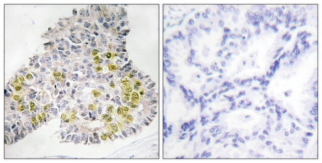 Anti-LKB1, C-Terminal antibody produced in rabbit affinity isolated antibody