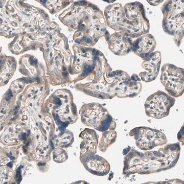 Anti-LIMK2 antibody produced in rabbit Prestige Antibodies&#174; Powered by Atlas Antibodies, affinity isolated antibody, buffered aqueous glycerol solution