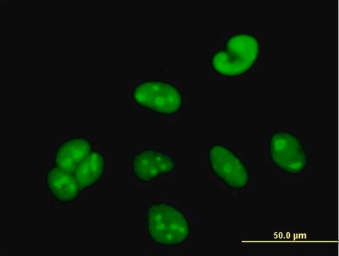 Anti-WBSCR22 antibody produced in mouse purified immunoglobulin, buffered aqueous solution