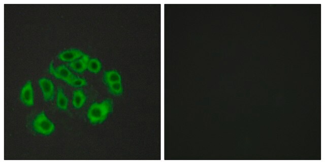 Anti-Mucin-14 antibody produced in rabbit affinity isolated antibody