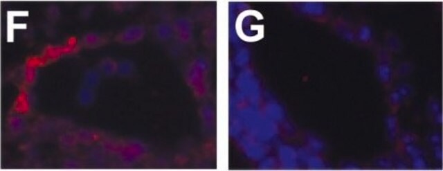 Anticorps monoclonal anti-&#945;-actine de muscle lisse clone 1A4, ascites fluid