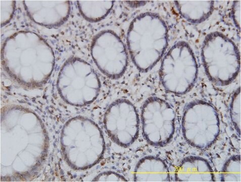 Monoclonal Anti-SPAST antibody produced in mouse clone 2F5, purified immunoglobulin, buffered aqueous solution