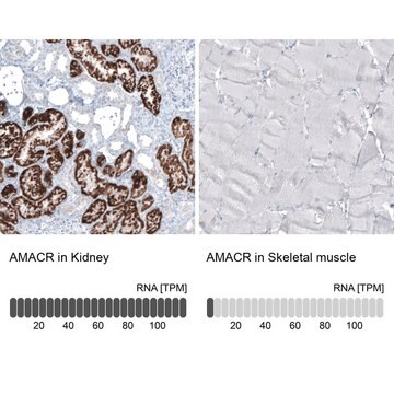 Monoclonal Anti-AMACR antibody produced in mouse Prestige Antibodies&#174; Powered by Atlas Antibodies, clone CL9360, purified immunoglobulin, buffered aqueous glycerol solution