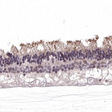 抗-RGS9BP 兔抗 Prestige Antibodies&#174; Powered by Atlas Antibodies, affinity isolated antibody, buffered aqueous glycerol solution