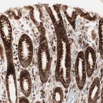 Anti-PPP2R5E antibody produced in rabbit Prestige Antibodies&#174; Powered by Atlas Antibodies, affinity isolated antibody, buffered aqueous glycerol solution