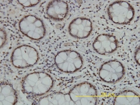 Monoclonal Anti-TLK2 antibody produced in mouse clone 2G7, purified immunoglobulin, buffered aqueous solution