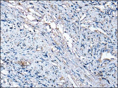 Anti-TUBB affinity isolated antibody