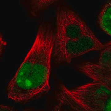 Anti-HJURP antibody produced in rabbit Prestige Antibodies&#174; Powered by Atlas Antibodies, affinity isolated antibody