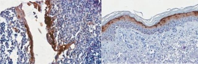 Anti-CALML5 Antibody, clone 3F6.1 clone 3F6.1, from mouse