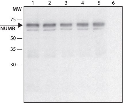 Anti-NUMB (C-terminal) antibody produced in rabbit ~1.0&#160;mg/mL, affinity isolated antibody