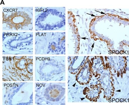 Anti-PRRX2 antibody produced in rabbit Prestige Antibodies&#174; Powered by Atlas Antibodies, affinity isolated antibody, buffered aqueous glycerol solution