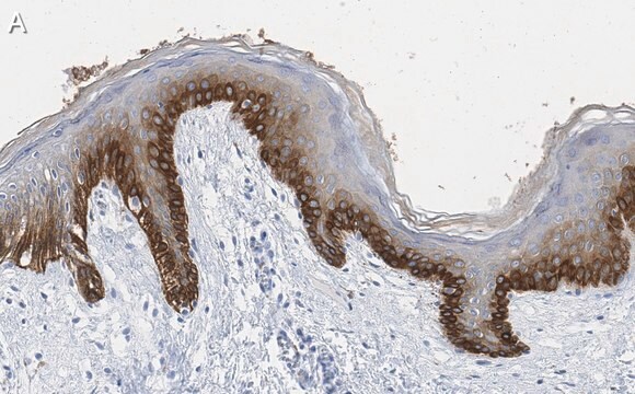 Anti-pan-cytokeratin Antibody, clone AE1 ZooMAb&#174; Mouse Monoclonal recombinant, expressed in HEK 293 cells