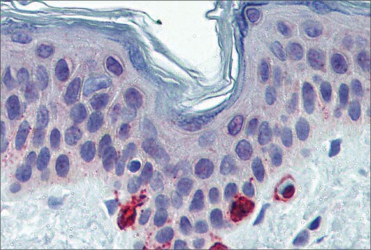 抗TYRP1抗体 ウサギ宿主抗体 affinity isolated antibody