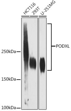 Anti-PODXL Antibody, clone 6S9A9, Rabbit Monoclonal