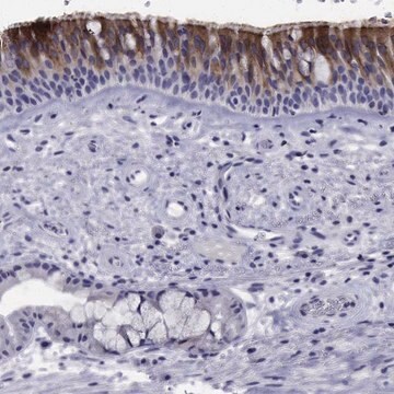 Anti-CDHR3 antibody produced in rabbit Prestige Antibodies&#174; Powered by Atlas Antibodies, affinity isolated antibody, buffered aqueous glycerol solution