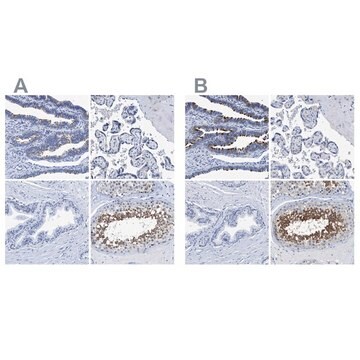 Anti-DNAI1 antibody produced in rabbit Prestige Antibodies&#174; Powered by Atlas Antibodies, affinity isolated antibody, buffered aqueous glycerol solution, Ab2