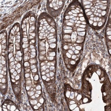 Anti-RICTOR antibody produced in rabbit Prestige Antibodies&#174; Powered by Atlas Antibodies, affinity isolated antibody, buffered aqueous glycerol solution