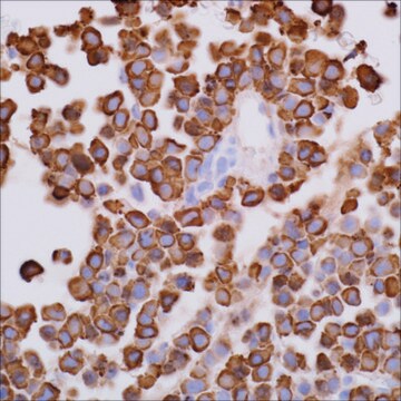 Lambda (EP172) Rabbit Monoclonal Primary Antibody